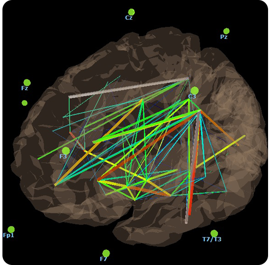 3D Brain Master Imaging